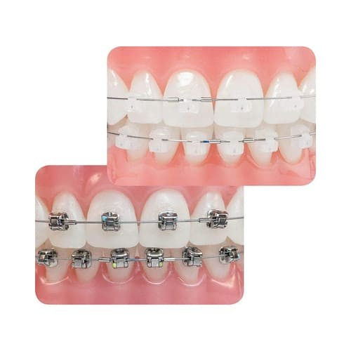 Dental Orthodontic Braces Ceramic Brackets Roth 022 with 345 3