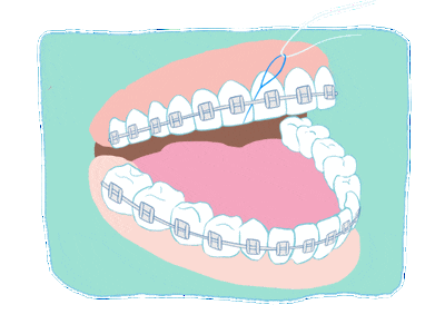 orthodontic before and after (6).gif